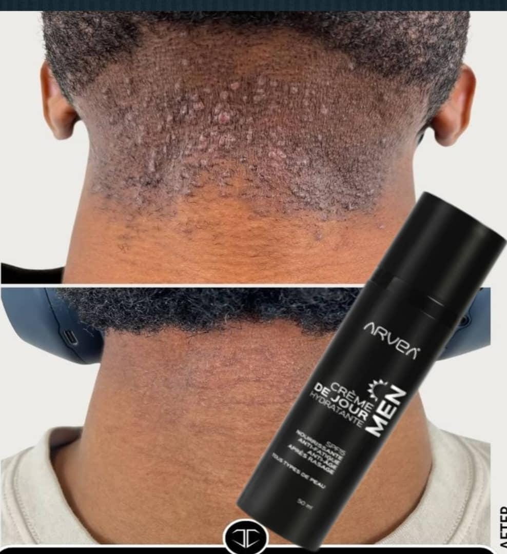 Soin Après-Rasage Anti-Fatigue